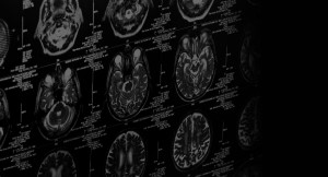 brain injury